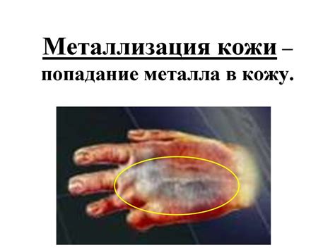 Вред металла на кожу