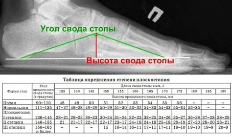Как происходит измерение степени закалки