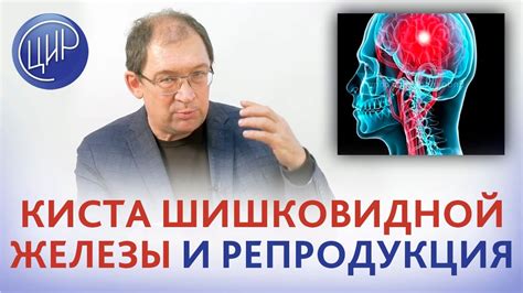 Киста на шишковидной железе: роль психосоматики