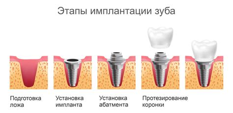 Основные причины выбора надежных способов крепления