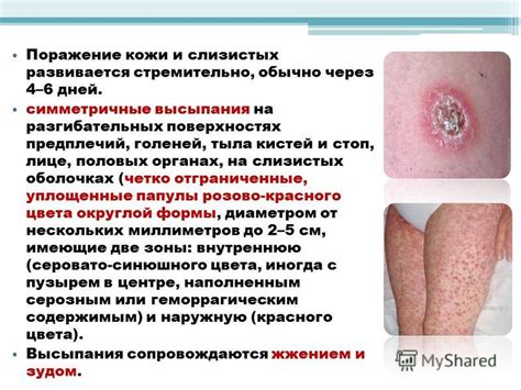 Поражение кожи и слизистых