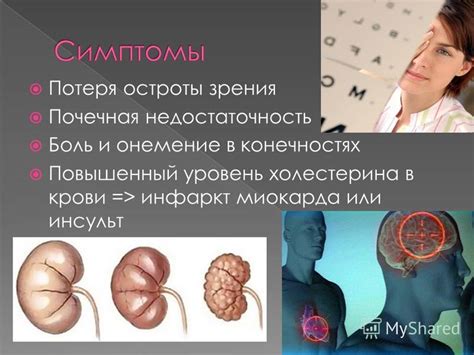 Потеря остроты зубьев