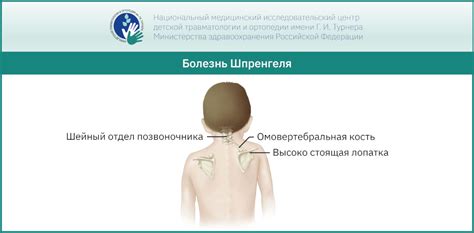Причины возникновения волосовины