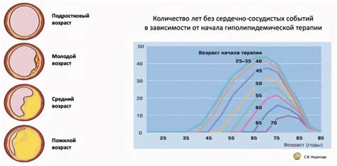 Прогрессирование