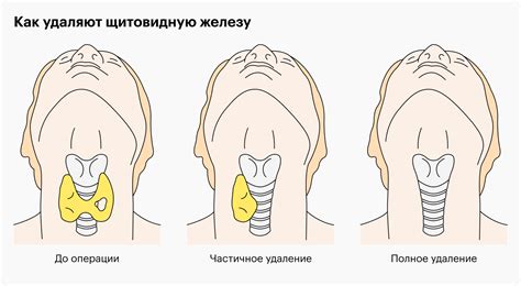 Четвертая стадия: ламинация и прокатка