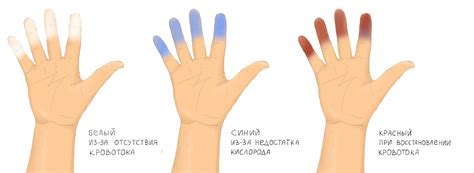 Анализ цвета пальцев у мертвеца