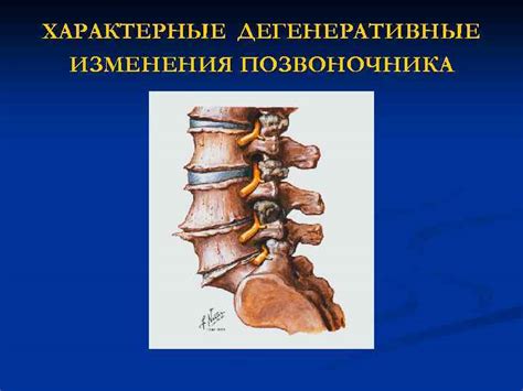 Дегенеративные изменения в позвоночнике