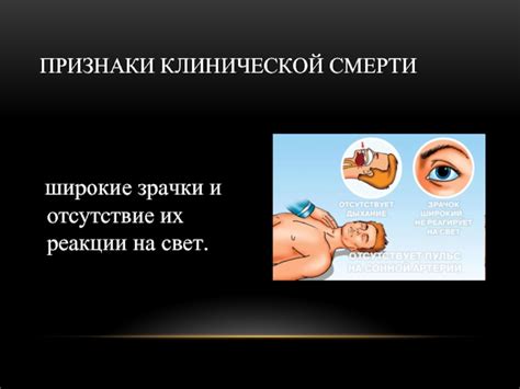 Отсутствие реакции на свет