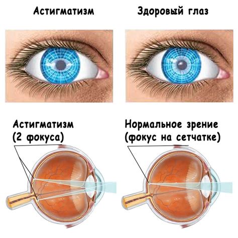 Причины выколотия глаз на фото