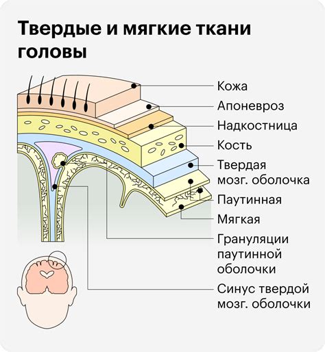 Причины самоизгиба