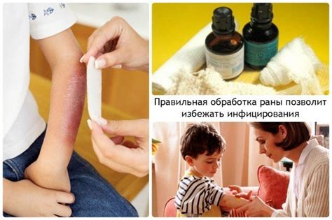 Как правильно обрабатывать рану чистотелом