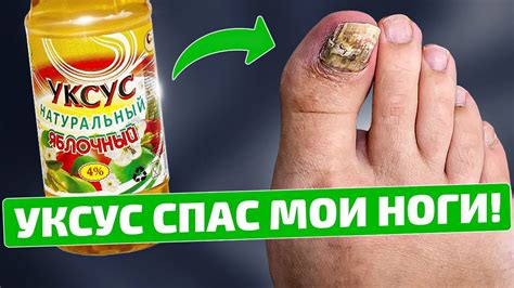 Очищение грибов от уксуса с помощью меда