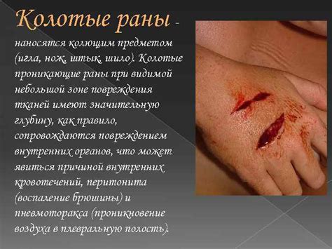 Физические упражнения и особенности заживления раны