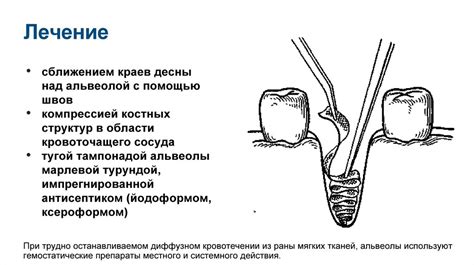 Причины удаления