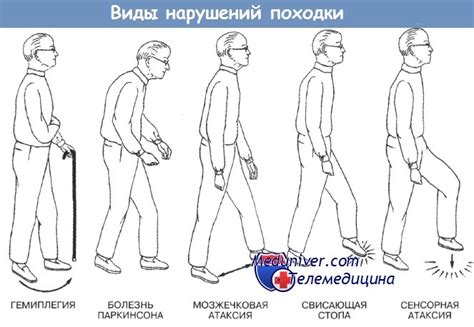 Раздел 3: Советы по использованию быстрой походки