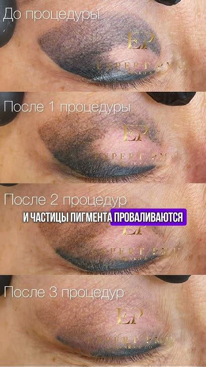Результаты удаления Геншина