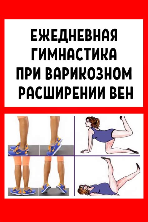 Упражнения для устранения мудлета