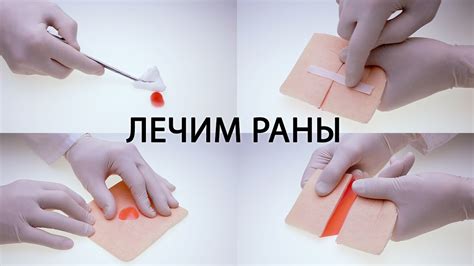 Что делать, если инструменты для зашивания раны недоступны