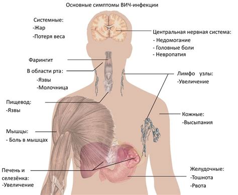 Что такое Инфернус и как он выглядит